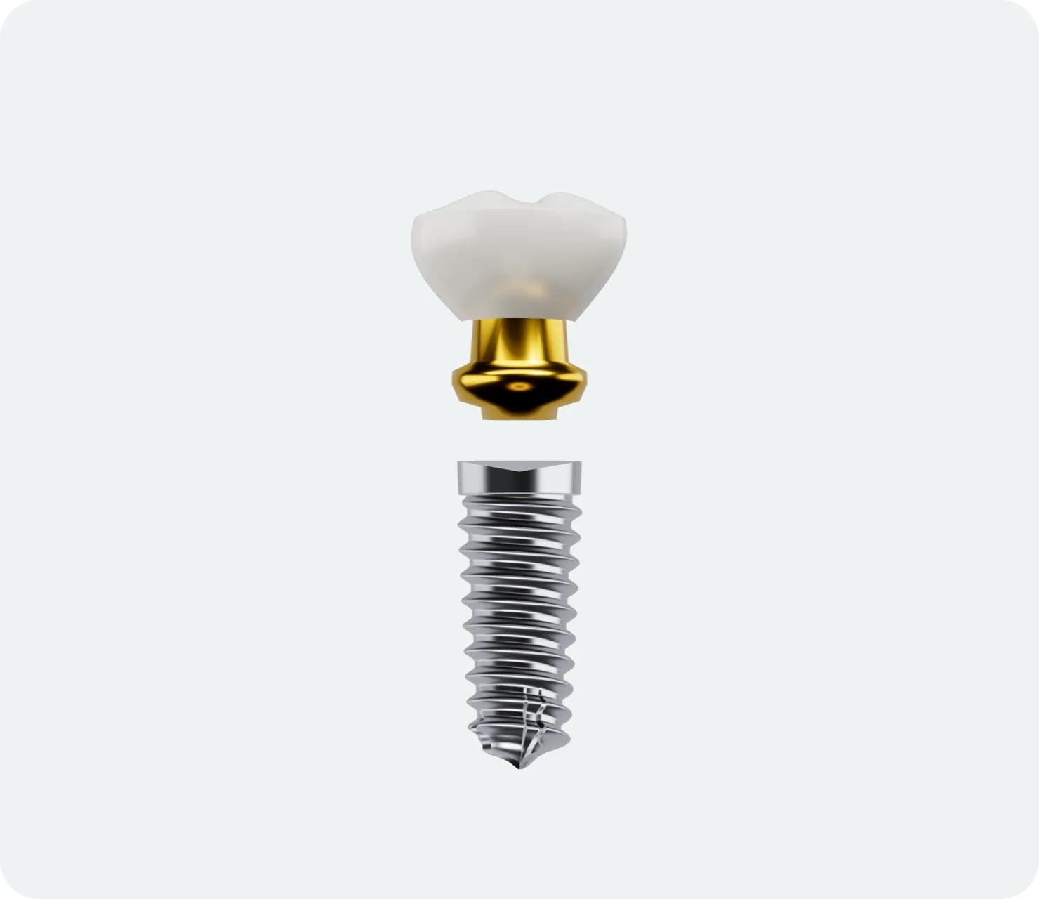 Illustration: Dental Implants